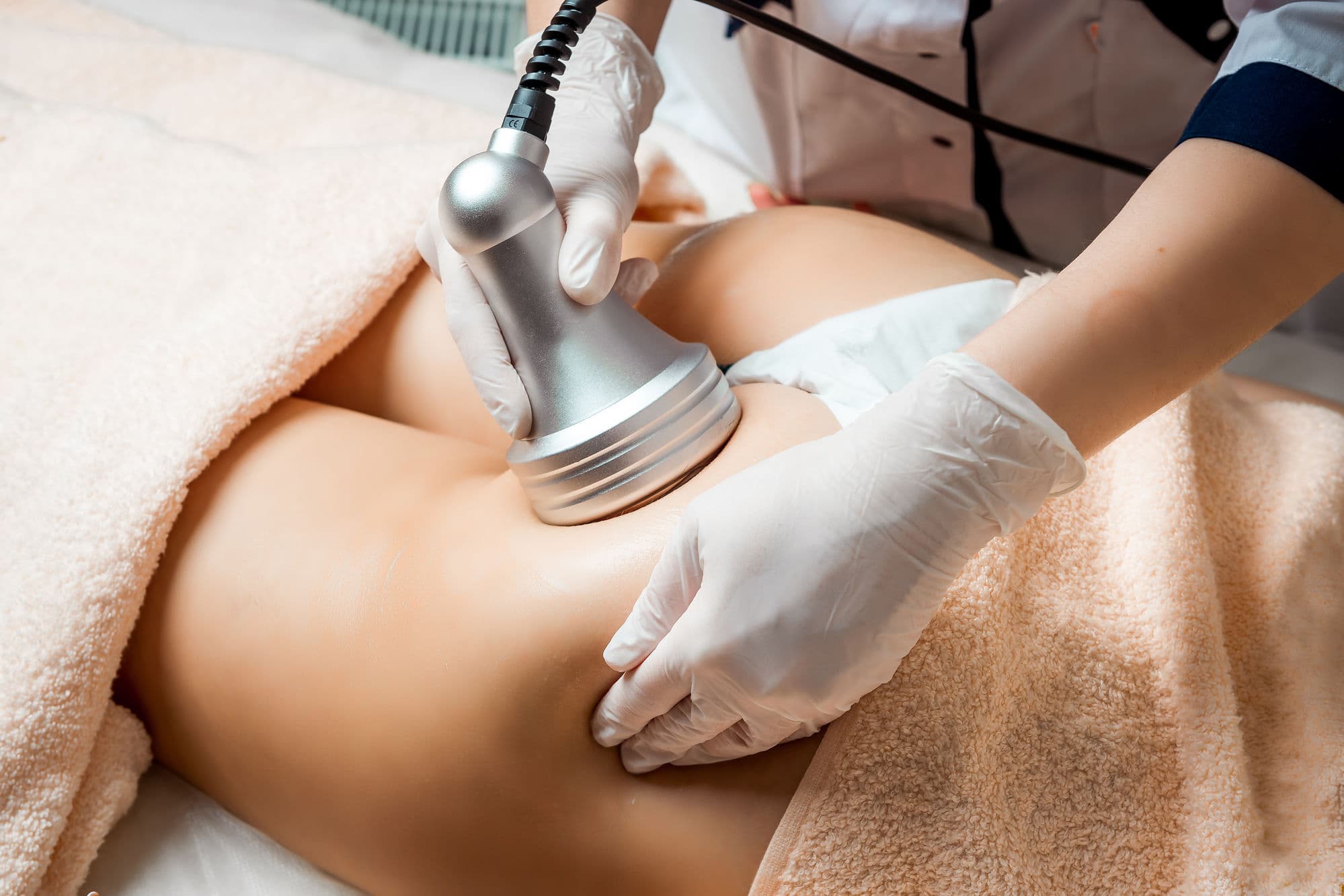 Body contouring treatment