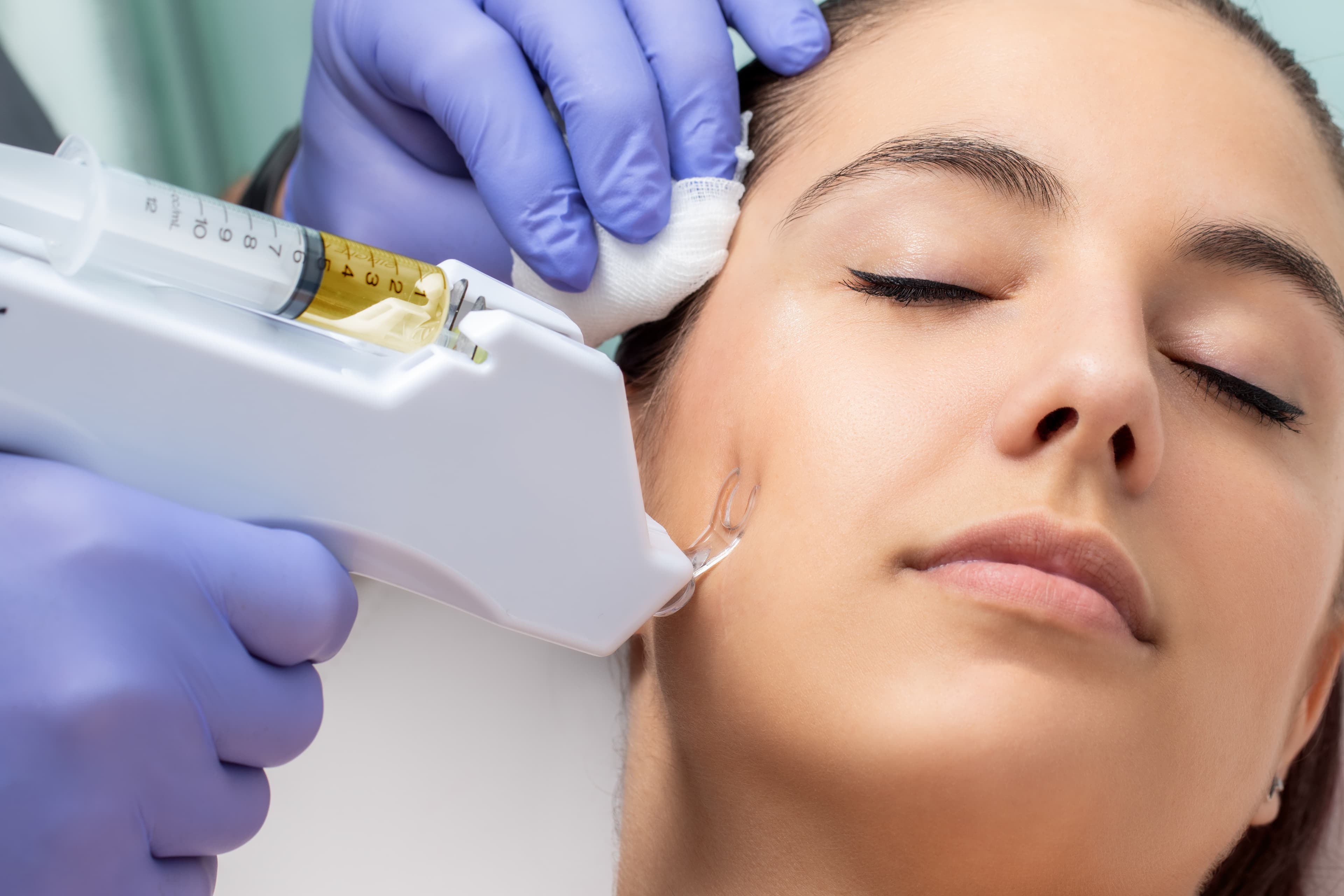 Mesotherapy microinjection treatment