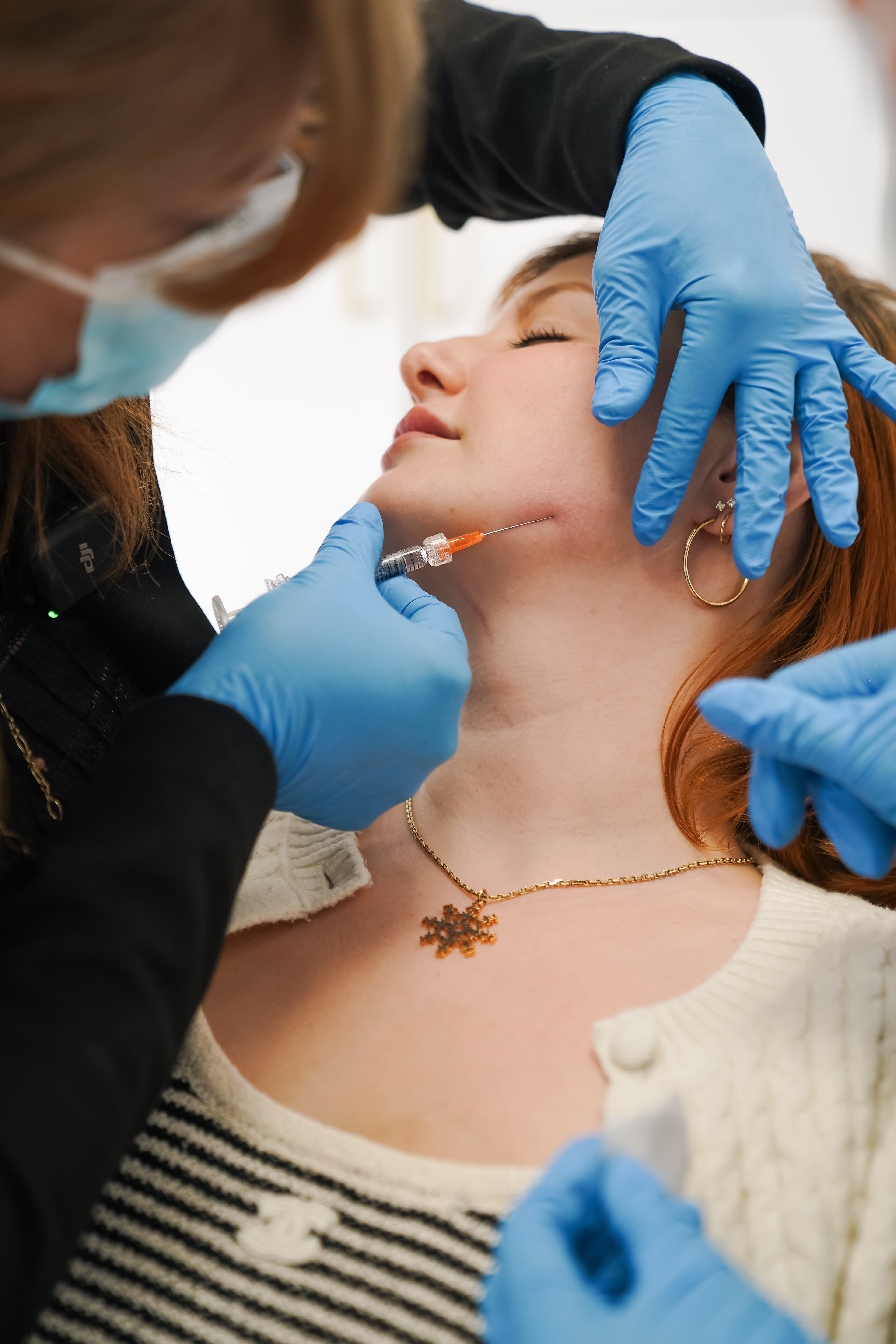 Botox and filler for facial balancing at FusionMed Toronto