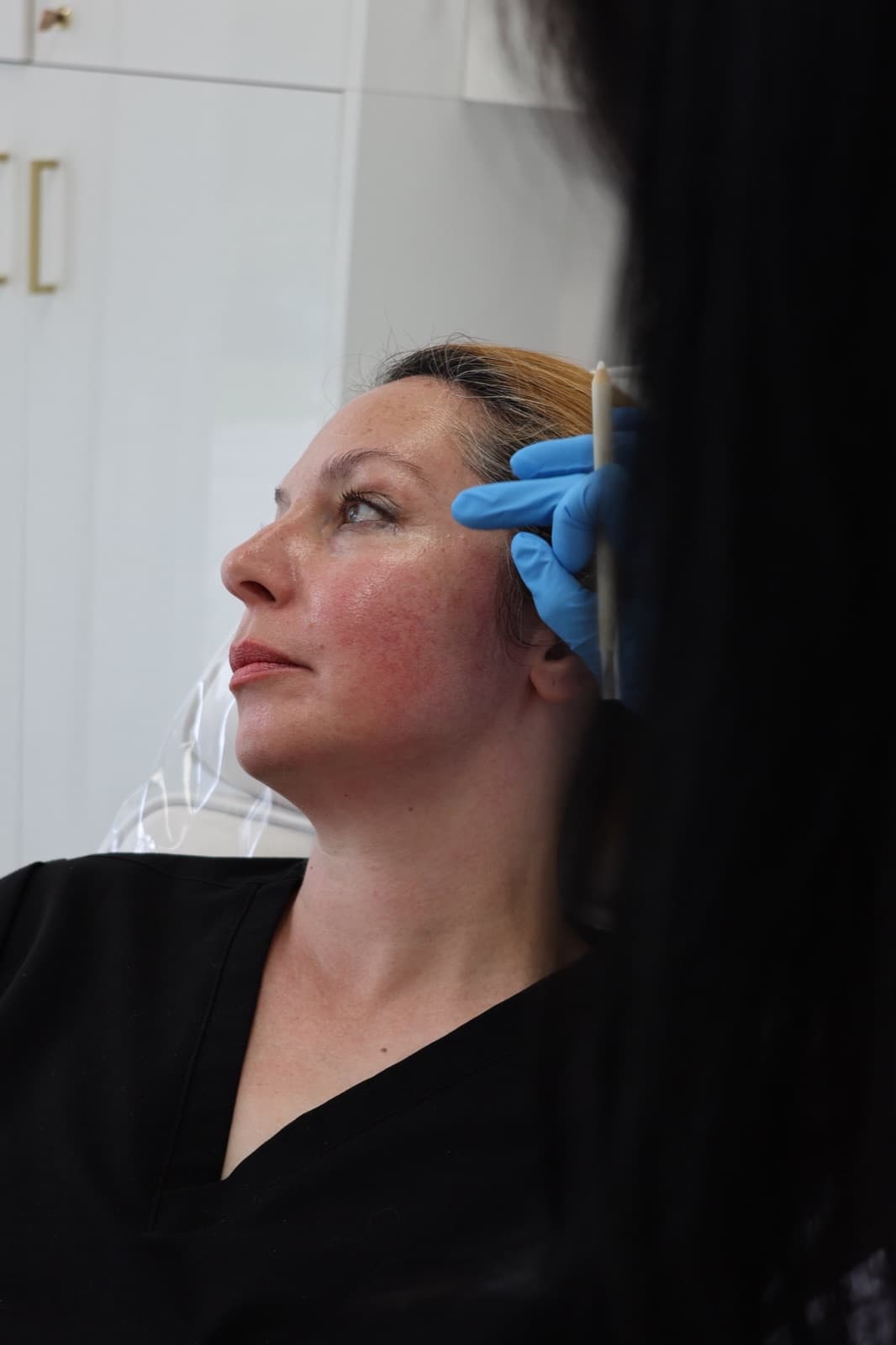 Clinician marking a client's face before an injectable treatment at FusionMed Toronto