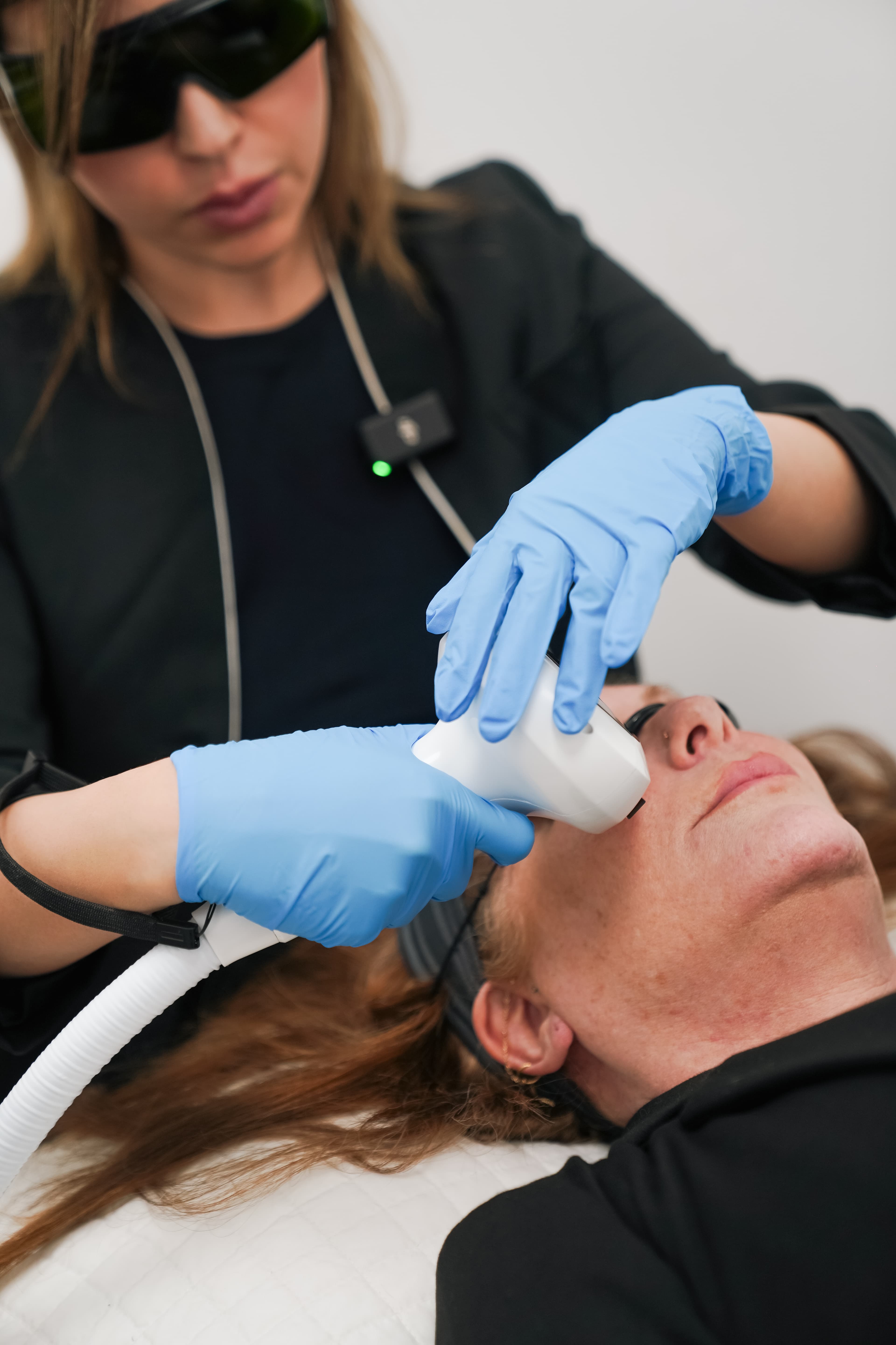 Skin resurfacing laser treatment