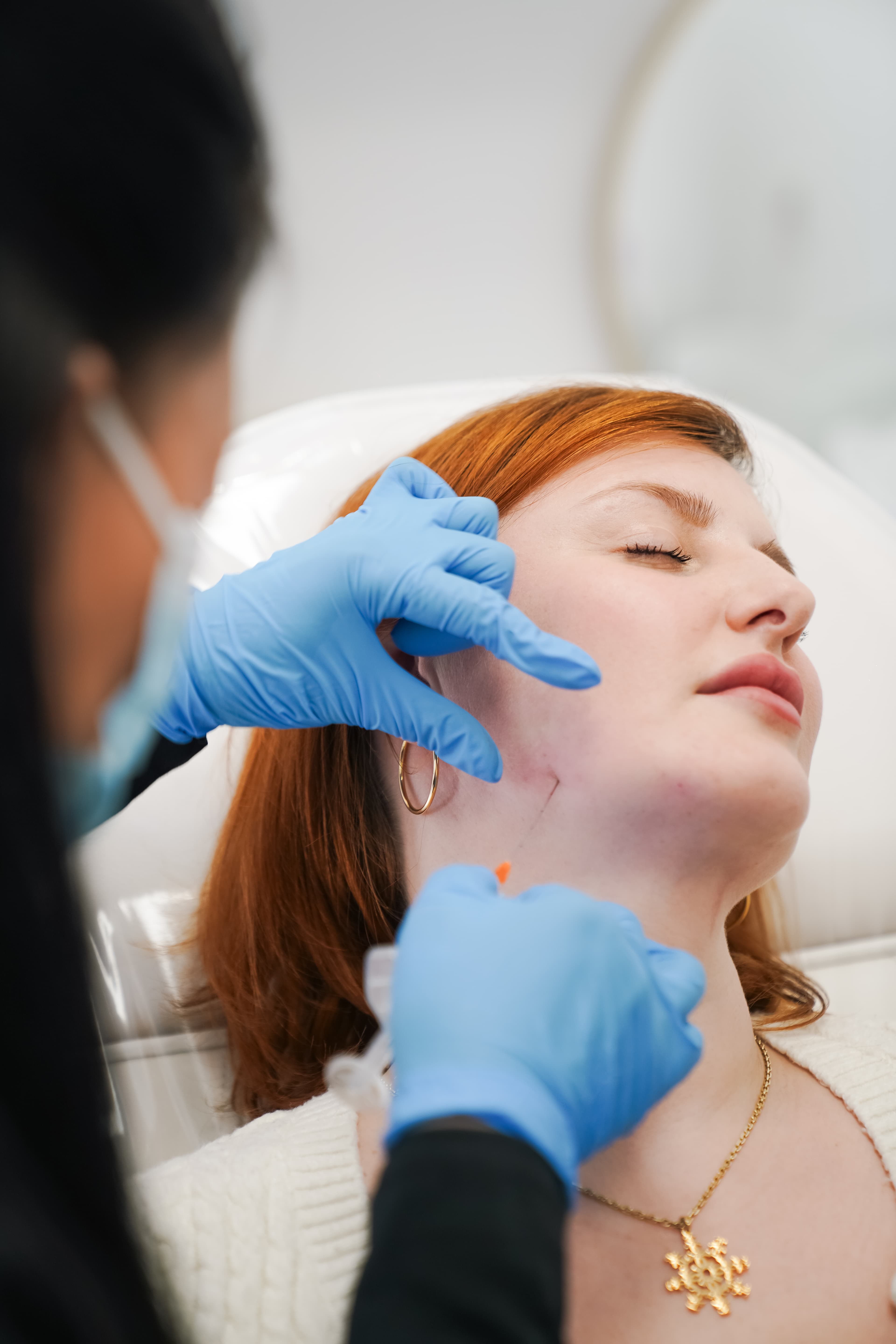 Thread lift procedure