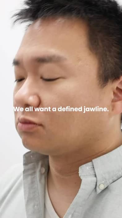 A defined jawline isn’t always a diet problem, sometimes it’s just fat that won’